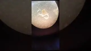 Strongyloides روعه الديدان الخيطية