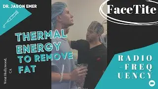 FaceTite: Use Thermal Energy To Remove Fat
