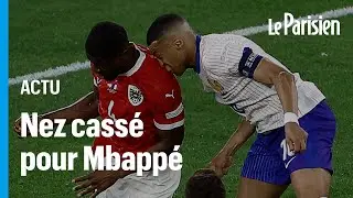 Euro 2024 : Kylian Mbappé s'est fracturé le nez lors du premier match des Bleus