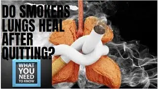 Do Smokers Lungs Heal After Quitting?