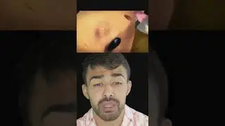 Жалко очень мальчика 😕 пр0д0лжение в коммент ах