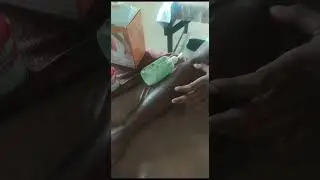 3 т. - тейпирование - 4
