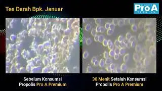 Tubuh lebih sehat dalam 30 menit  #Propolis #Proa #herbal #suplemen #propolisterbaik