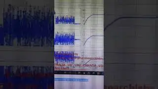 Model of Solar MPPT with PSO and AI based techniques under partial shading condition-Matlab Simulink