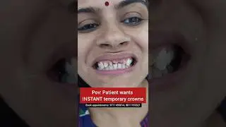 INSTANT temporary tooth caps in 15 minutes! Dr. Srishti Bhatia 