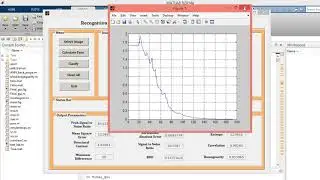 Osteoporosis of bone detection using Digital image processing MATLAB project source code