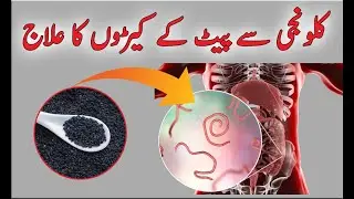 Pait Ke Keeron Ka Ilaj || Intestinal Worms Treatment in Urdu/Hindi | Home Remedies for Stomach Worms