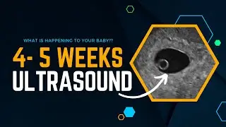 4 Weeks Pregnant - What is happening? to your baby | Ultrasound