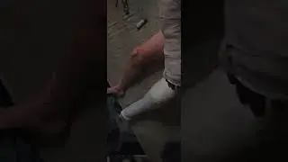 arm legcast fetish