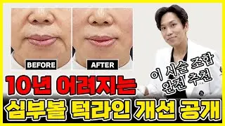 10년 어려지는 심부볼 턱라인개선! 전 과정을 생생히 보여드려요!(feat.울쎄라,실리프팅) 천호울쎄라, 천호실리프팅