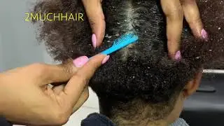 Dandruff Scratch Patch X3... Steph is Back!!!