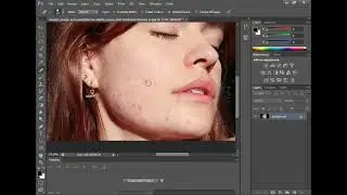 How to get rid of acne in photoshop ?