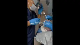 Discover the incredible benefits of DHI hair transplants