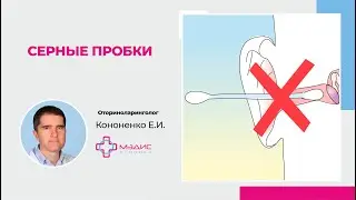 115.15. Серные пробки.Что делать с серными пробками. Кононенко Евгений Игоревич, ЛОР