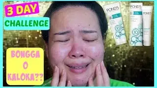 Pond's Acne Clear | 3 Day Challenge on Acne Prone Skin | Bongga O Kaloka?!