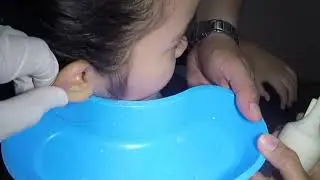 Something White flushed Out from Girl's Ear