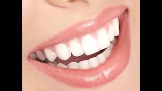 Mosaic Dentistry REVIEWS  (480) 883-0222 Dentist Chandler, AZ