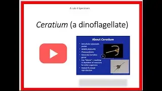 Ceratium