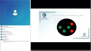 Подбор очковой коррекции пациентам после ФЭМ с имплантацией интраокулярной линзы #коррекциязрения