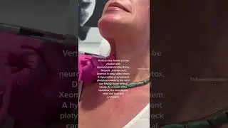 Botox For Neck Bands