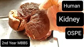 Human Kidney OSPE 