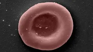 First ever clinical trial of lab-grown red blood cell transfusion