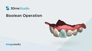 Boolean Operation | Imagoworks Technology (2021 Jun)