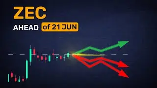 Is there a consensus? ZEC forecast in 1 day