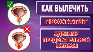 Лечение простатита и аденомы предстательной железы в домашних условиях