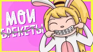 ИСТОРИЯ МОИХ БРЕКЕТОВ 🦷😁 (Анимация КЛЭР)