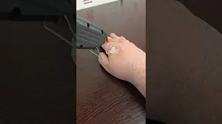 Горячий клей попал на руку. Последствия