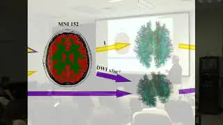 Neuroimagen 2017-Mining Developmental Disorders-John D. Lewis
