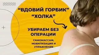 Лечение холки (горба) на шее. Рекомендации и упражнения, которые точно помогут!
