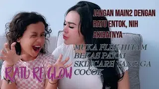 Jangan Main2 Dengan Ratu Entok, Nih Akibatnya || Muka Flek Hitam Bekas Pemakaian Skincare Lain.
