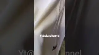 begini caranya kalau ada noda kuning