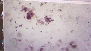 French bulldog foul sperm sample