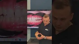 консультация стоматолога