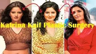 Katrina Kaif Plastic Surgery Before and After