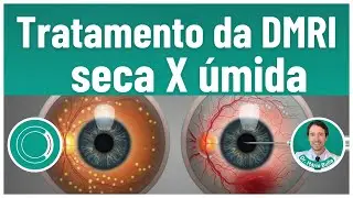 Treatment of dry AMD vs. wet AMD