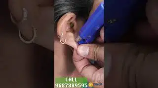 Ear Repair /Earlobe / Hole Repair By Ear Pasting lotion / Torn Ear lobe Repaired Earlobe -9687889595