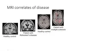 Next level medical imaging analysis. -Prof. Dr. Kerstin Ritter