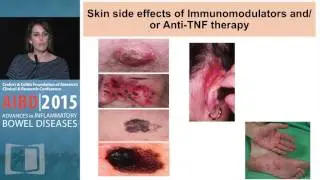 How Can We Prevent and Manage the Common Side Effects of Immunomodulators and Biologics?