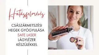 Császármetszési hegek gyógyulása Safe Laser lágylézer készülékkel - Hatásfelmérés