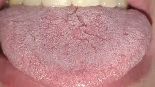 Touching my uvula and tonsils | VORE VIDEO | MOUTH AND UVULA
