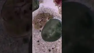 Amoeba captured paramecia and stentor #shorts