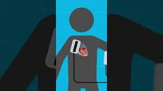 How Do Defibrillators Actually Work? DEBUNKED #moviemyths #sciencefacts #debunked