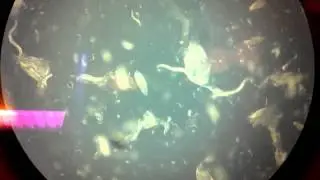 C. elegans twitching after RNA interference of unc-22 gene.