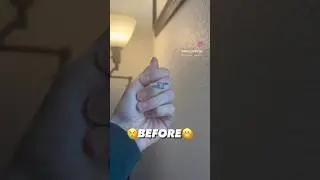 hiding my vitamin D deficiency with press ons lol…. 