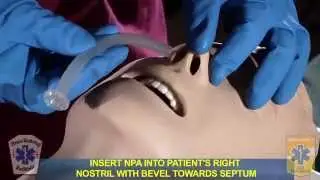 NYS EMT Skills (OPA/NPA/Suction)