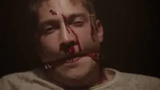 World Record For Nails In The Head Before Death